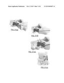 ORTHOPEDIC DUAL POCKET COMPRESSION PLATE AND METHOD OF SURGERY diagram and image