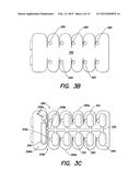 FLEXIBLE AND/OR TAPERED THERAPY ELECTRODE diagram and image