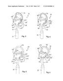 STAPES PROSTHESIS WITH SNAP CLOSURE diagram and image