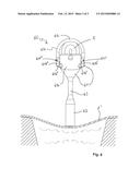 STAPES PROSTHESIS WITH SNAP CLOSURE diagram and image