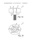 Method For Manufacturing Dental Implant Components diagram and image