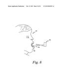 Method For Manufacturing Dental Implant Components diagram and image