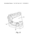 Method For Manufacturing Dental Implant Components diagram and image