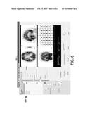 SYSTEM AND METHOD FOR IMPROVING NEUROLOGIST S WORKFLOW ON ALZEIMER S     DISEASE diagram and image