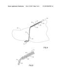 SOLE-LESS SANDAL diagram and image