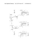 CUSHION FOR PATIENT INTERFACE diagram and image