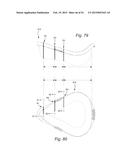 CUSHION FOR PATIENT INTERFACE diagram and image