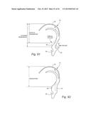 CUSHION FOR PATIENT INTERFACE diagram and image