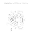 CUSHION FOR PATIENT INTERFACE diagram and image