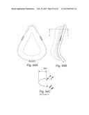 CUSHION FOR PATIENT INTERFACE diagram and image