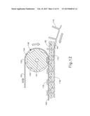 SURGICAL STAPLER WITH ROLLING ANVIL diagram and image