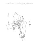 SURGICAL STAPLER WITH ROLLING ANVIL diagram and image