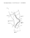 ANGULAR DISPLACEMENT SENSOR OF COMPLIANT MATERIAL diagram and image