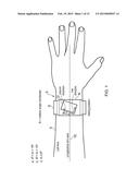 WRIST WORN DEVICE diagram and image