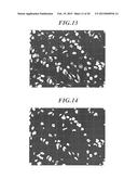 MEDICAL IMAGE PROCESSOR AND STORAGE MEDIUM diagram and image