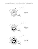 COLORIMETRIC INDICATORS FOR USE IN MEDICAL DEVICES diagram and image