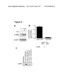 TREATMENT OF FIBROSIS diagram and image