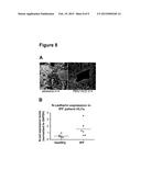 TREATMENT OF FIBROSIS diagram and image