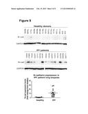 TREATMENT OF FIBROSIS diagram and image