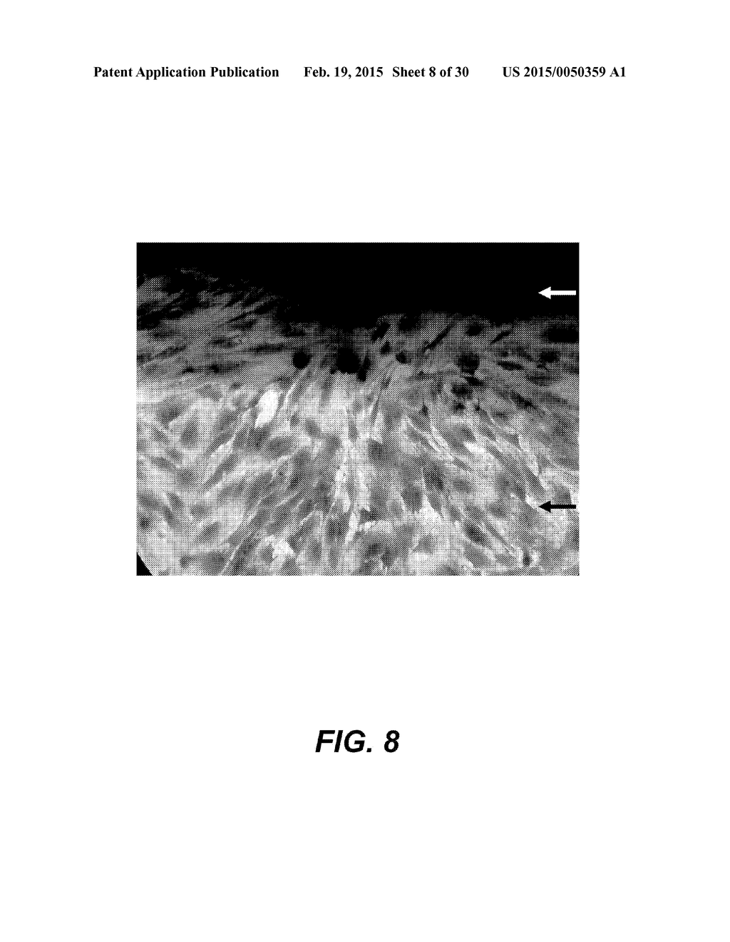 DECELLULARISATION OF TISSUE MATRICES FOR BLADDER IMPLANTATION - diagram, schematic, and image 09