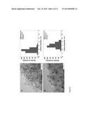 HIGHLY SINTER-STABLE METAL NANOPARTICLES SUPPORTED ON MESOPOROUS GRAPHITIC     PARTICLES AND THEIR USE diagram and image