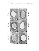 HUMAN SOLUBLE RECEPTOR FOR ADVANCED GLYCATION END PRODUCTS (sRAGE),     METHODS OF PREPARING HUMAN sRAGE, AND TREATMENT METHODS USING sRAGE diagram and image