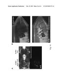 CELLULOSE-/CHITIN-TYPE POLYMERIC LIGHT-EMITTING MATERIAL diagram and image