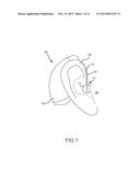 DIRECTIONALITY DEVICE FOR AUDITORY PROSTHESIS MICROPHONE diagram and image