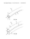 DIRECTIONALITY DEVICE FOR AUDITORY PROSTHESIS MICROPHONE diagram and image