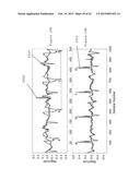 APPARATUS, METHOD AND COMPUTER-ACCESSIBLE MEDIUM FOR TRANSFORM ANALYSIS OF     BIOMEDICAL DATA diagram and image