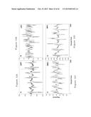 APPARATUS, METHOD AND COMPUTER-ACCESSIBLE MEDIUM FOR TRANSFORM ANALYSIS OF     BIOMEDICAL DATA diagram and image