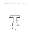 SUDOMOTOR FUNCTION FOR PERIPHERAL DIABETIC NEUROPATHY EVALUATION diagram and image