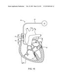 Ingestible Event Marker Systems diagram and image