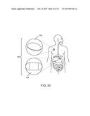 Ingestible Event Marker Systems diagram and image