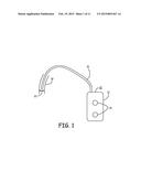 IMPLANTABLE DEVICE AND METHOD FOR MONITORING VENOUS DIAMETER diagram and image