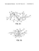 IMPLANTABLE DEVICE AND METHOD FOR MONITORING VENOUS DIAMETER diagram and image