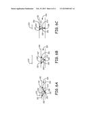 IMPLANTABLE DEVICE AND METHOD FOR MONITORING VENOUS DIAMETER diagram and image