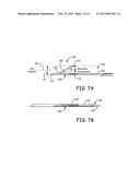 IMPLANTABLE DEVICE AND METHOD FOR MONITORING VENOUS DIAMETER diagram and image