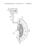 RADIO OPAQUE, REDUCED-PRESSURE MANIFOLDS, SYSTEMS, AND METHODS diagram and image