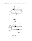 DEVICES AND METHODS FOR DENERVATION OF THE NERVES SURROUNDING THE     PULMONARY VEINS FOR TREATMENT OF ATRIAL FIBRILLATION diagram and image