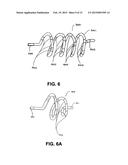 DEVICES AND METHODS FOR DENERVATION OF THE NERVES SURROUNDING THE     PULMONARY VEINS FOR TREATMENT OF ATRIAL FIBRILLATION diagram and image