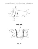 DEVICES AND METHODS FOR DENERVATION OF THE NERVES SURROUNDING THE     PULMONARY VEINS FOR TREATMENT OF ATRIAL FIBRILLATION diagram and image