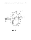 DEVICES AND METHODS FOR DENERVATION OF THE NERVES SURROUNDING THE     PULMONARY VEINS FOR TREATMENT OF ATRIAL FIBRILLATION diagram and image