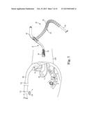 SURGICAL SYSTEM INCLUDING A SUPPORT FOR AN INSTRUMENT diagram and image