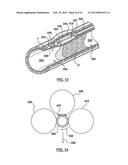 Balloon Catheter Systems and Methods for Bypassing an Occlusion in a Blood     Vessel diagram and image