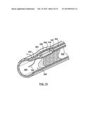 Balloon Catheter Systems and Methods for Bypassing an Occlusion in a Blood     Vessel diagram and image