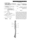 ORTHOPEDIC BONE FIXATION SYSTEMS AND METHODS diagram and image