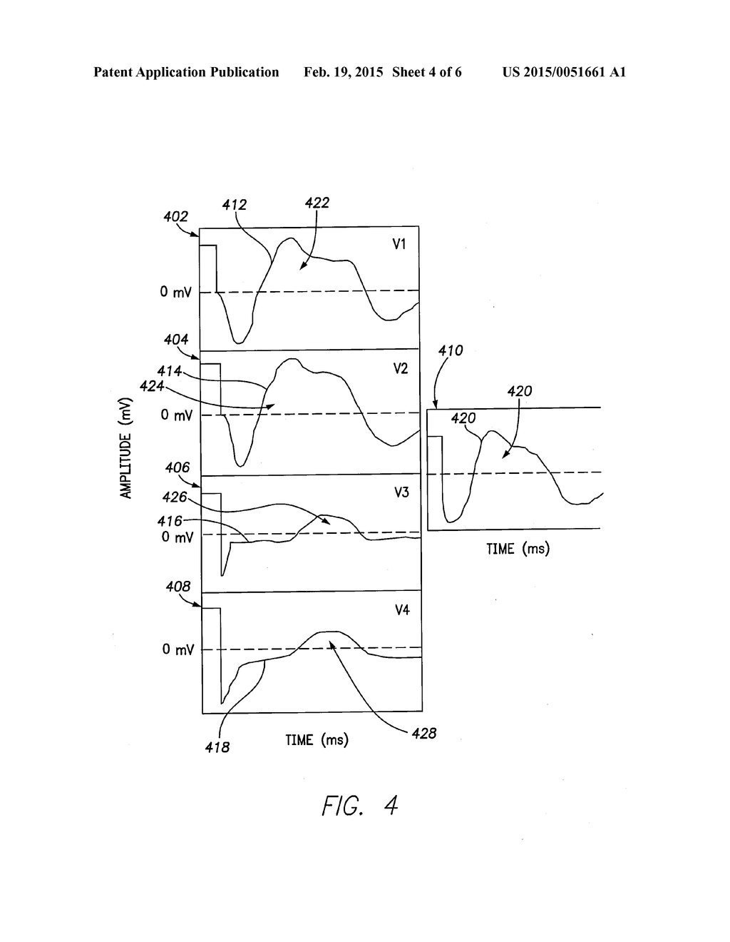 Method and System for Validating Local Capture in Multisite Pacing     Delivery - diagram, schematic, and image 05