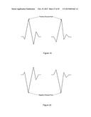 CARDIAC RESPONSE CLASSIFICATION USING MULTISITE SENSING AND PACING diagram and image