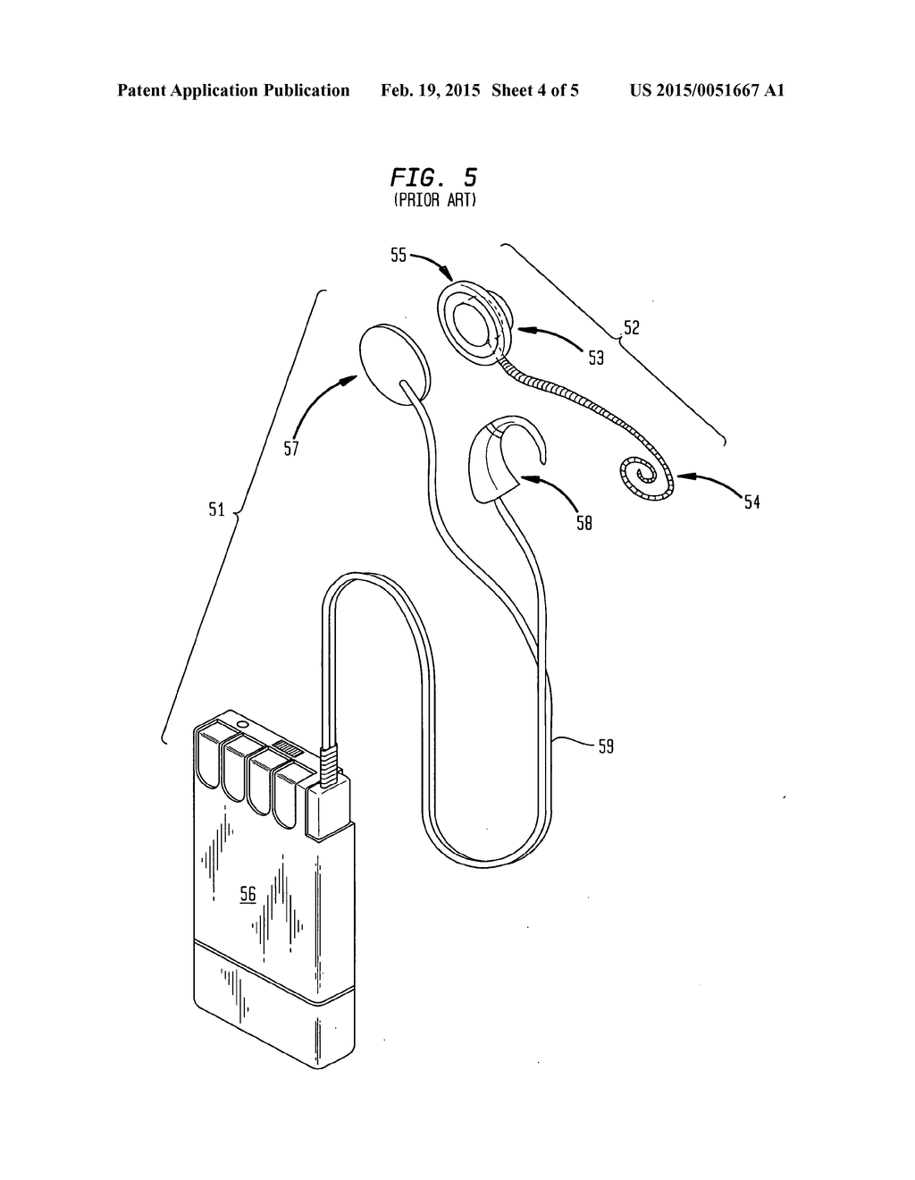 HEARING PROSTHESIS SYSTEM HAVING INTERCHANGEABLE HOUSINGS - diagram, schematic, and image 05